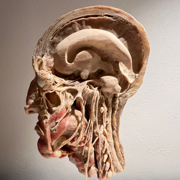 mente-hp Omicidi seriali - Vittime e carnefici in mostra a Palazzo del Monferrato